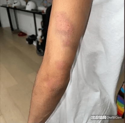 曝布里奇斯将在明日受审！面临多项重罪指控：罪名成立将多年监禁